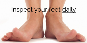 care of your feet